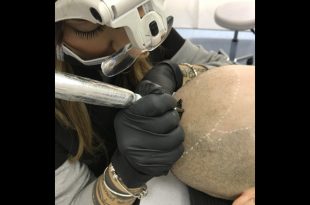 Giorgia Venuto a lavoro sulla Tricopigmentazione